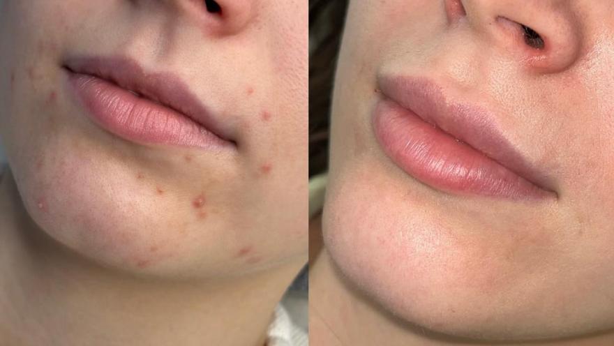 Зозулька Fest