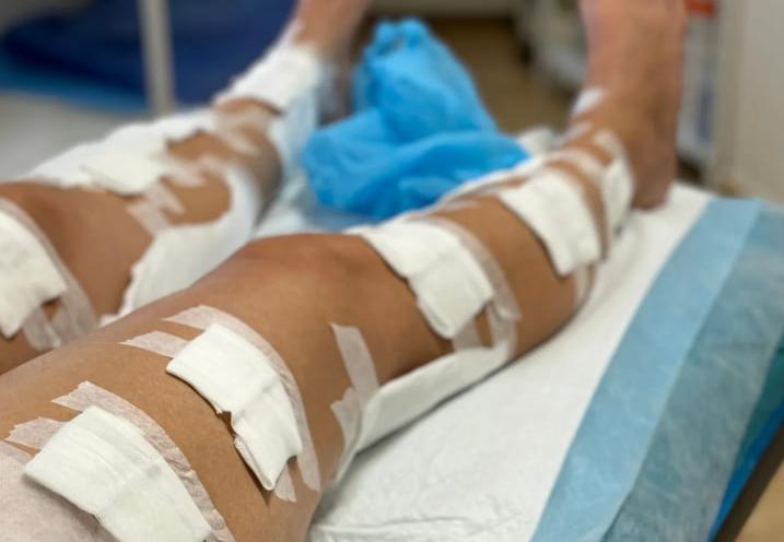 Клініка флебології Артема Чеховського