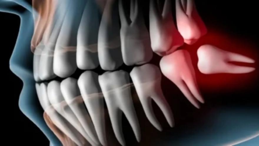 Юрчишак Дент