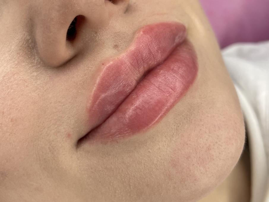 Са-Ната Естетік