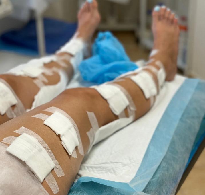 Клініка флебології Артема Чеховського