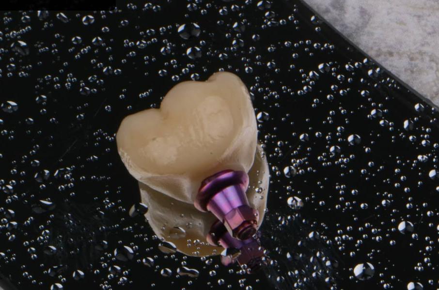 Аполінарія