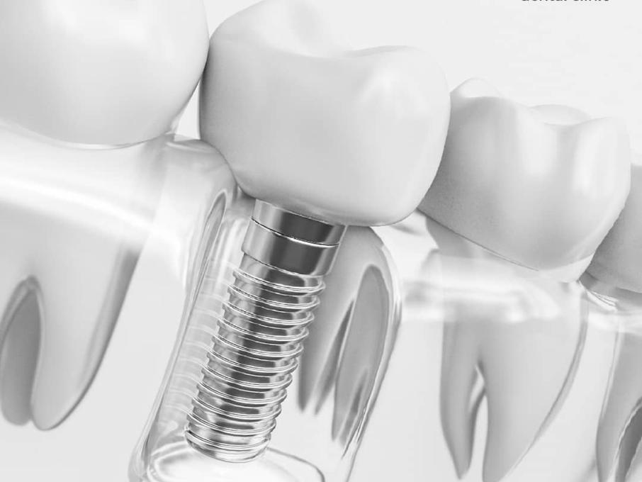 Precision Dental Clinic