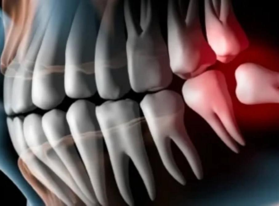 Юрчишак Дент