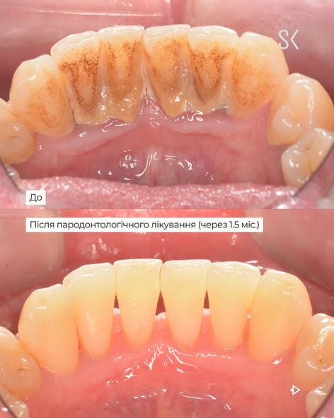 Solonko Sovyak Center