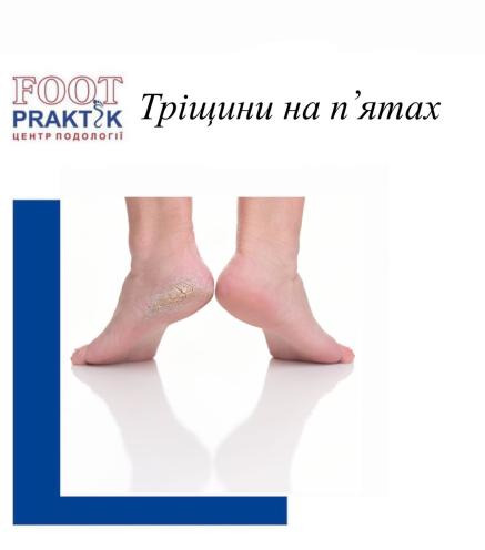 FootPraktik