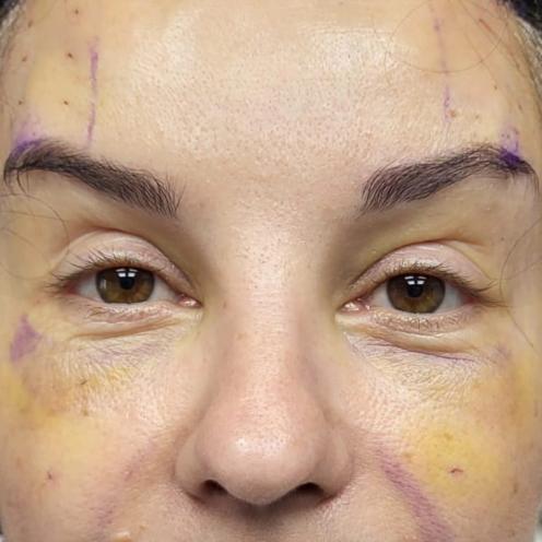 Pro Cosmetic