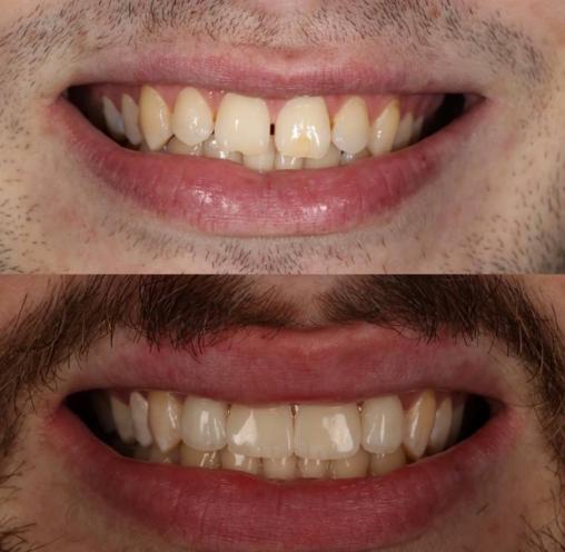 Team Dental