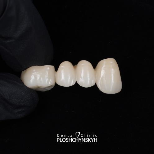 Ploshchynskyh Dental