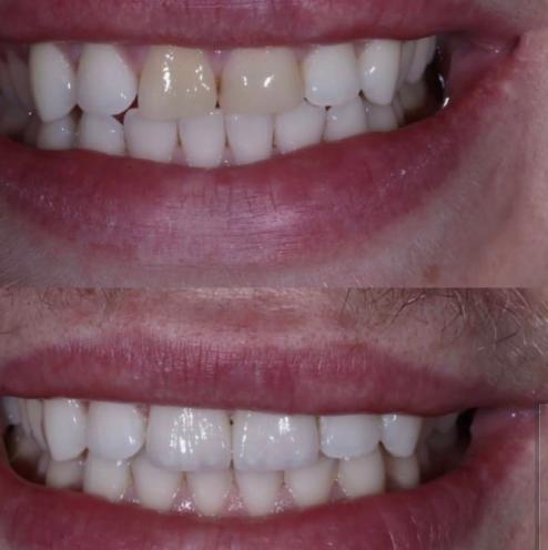 Dental Lviv