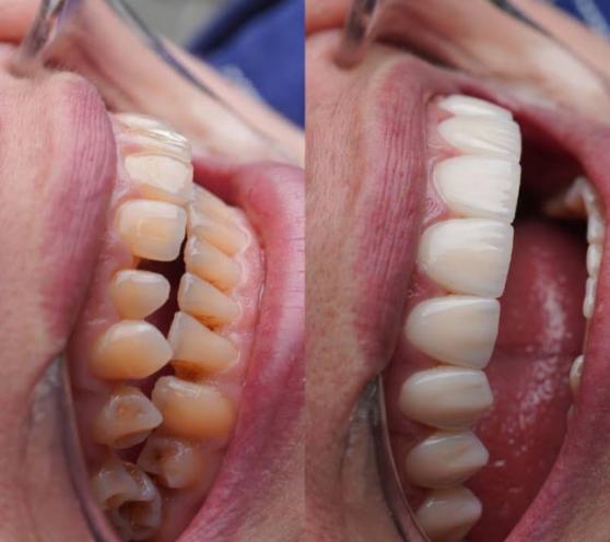 Dental Lviv