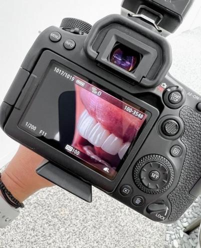Dental Story
