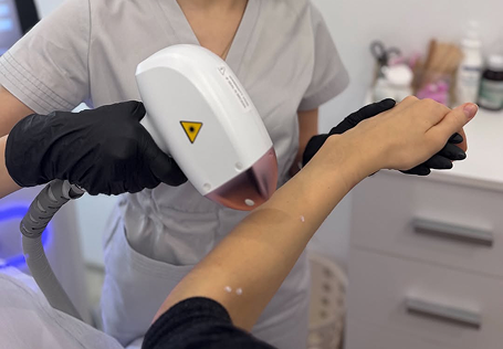 LASER SKIN