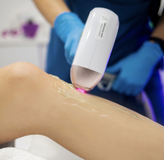 MIUSlaser