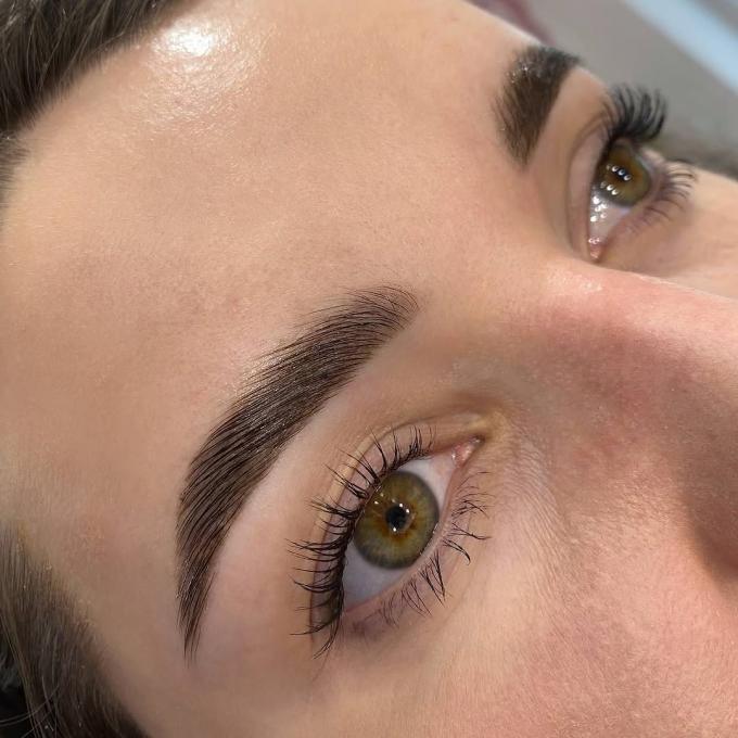 L'estetica