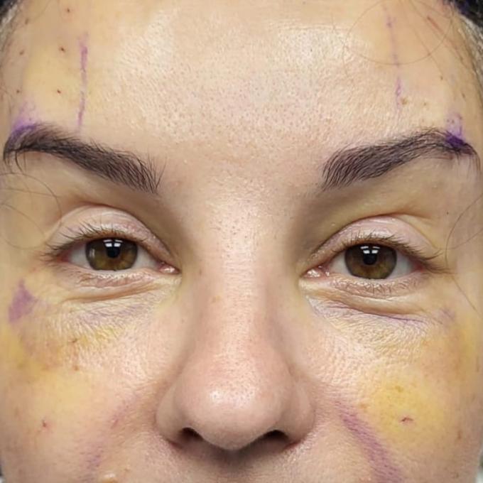 Pro Cosmetic