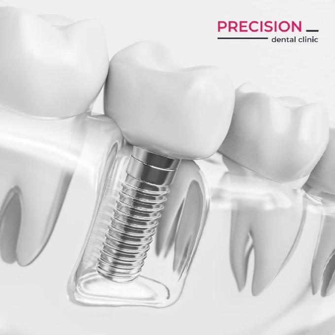 Precision Dental Clinic