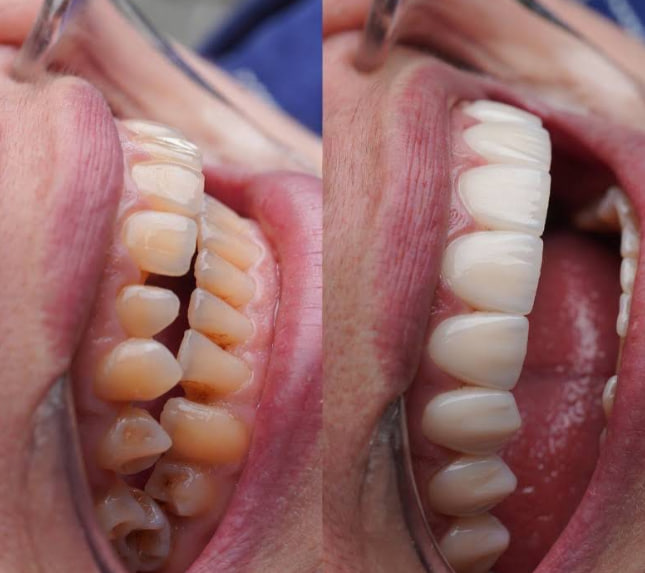 Dental Lviv