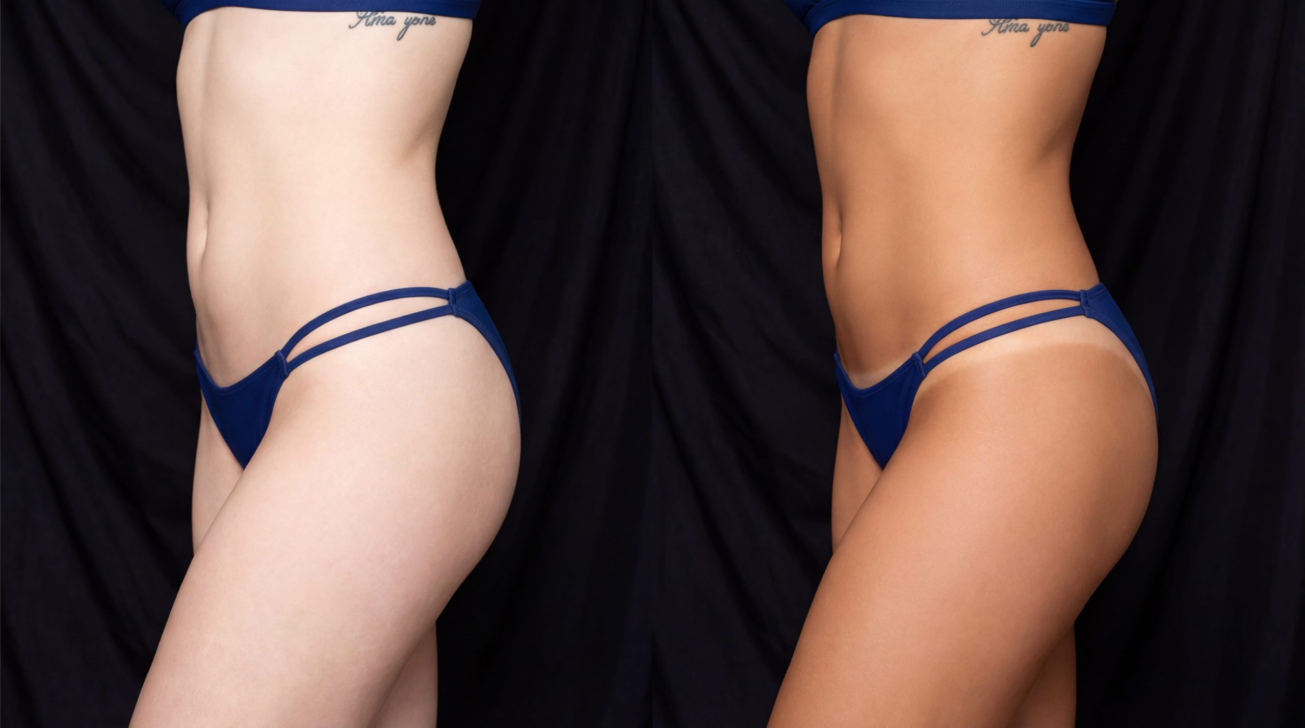 Lumea Body