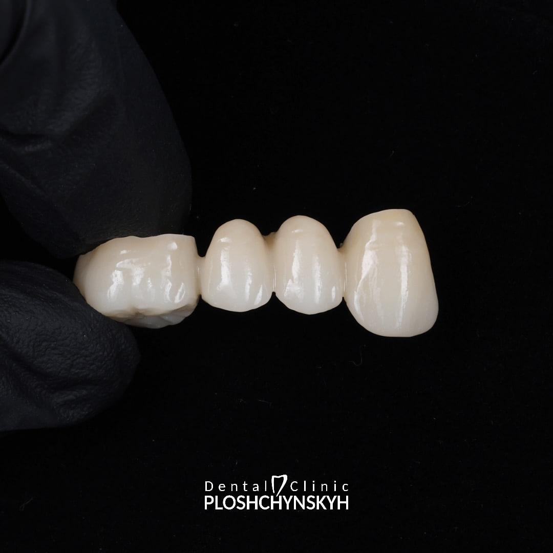 Ploshchynskyh Dental